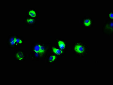 Immunofluorescence staining of MCF-7 cells with ECSCR Antibody at 1:133, counter-stained with DAPI. The cells were fixed in 4% formaldehyde, permeabilized using 0.2% Triton X-100 and blocked in 10% normal Goat Serum. The cells were then incubated with the antibody overnight at 4°C. The secondary antibody was Alexa Fluor 488-congugated AffiniPure Goat Anti-Rabbit IgG(H+L).Rabbit anti-Human ECSCR Polyclonal Antibody