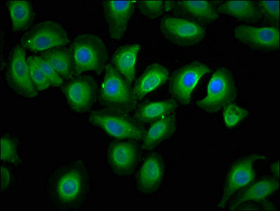 Immunofluorescence staining of A549 cells with ECSCR Antibody at 1:133, counter-stained with DAPI. The cells were fixed in 4% formaldehyde, permeabilized using 0.2% Triton X-100 and blocked in 10% normal Goat Serum. The cells were then incubated with the antibody overnight at 4°C. The secondary antibody was Alexa Fluor 488-congugated AffiniPure Goat Anti-Rabbit IgG(H+L).Rabbit anti-Human ECSCR Polyclonal Antibody