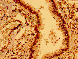 Immunohistochemistry of paraffin-embedded human lung tissue using the antibody at dilution of 1:100Rabbit anti-Human ECSCR Polyclonal Antibody