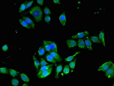 Immunofluorescent analysis of PC-3 cells using EDNRB Antibody at dilution of 1:100 and Alexa Fluor 488-congugated AffiniPure Goat Anti-Rabbit IgG(H+L)Rabbit anti-Human EDNRB Polyclonal Antibody