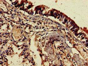 Immunohistochemistry of paraffin-embedded human lung tissue using EDNRB Antibody at dilution of 1:100Rabbit anti-Human EDNRB Polyclonal Antibody