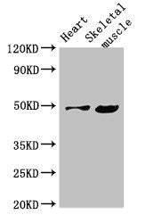 Western Blot  | Positive WB detected in: Mouse heart tissue, Mouse skeletal muscle tissue  | All lanes: EDNRB antibody at 4μg/ml  | Secondary  | Goat polyclonal to rabbit IgG at 1/50000 dilution  | Predicted band size: 50, 49, 60 kDa  | Observed band size: 50 kDaRabbit anti-Human EDNRB Polyclonal Antibody