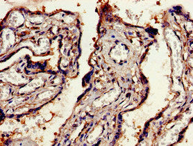 Immunohistochemistry of paraffin-embedded human placenta tissue using EEA1 Antibody at dilution of 1:100Rabbit anti-Human EEA1 Polyclonal Antibody