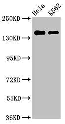 Western Blot  | Positive WB detected in: Hela whole cell lysate, K562 whole cell lysate  | All lanes: EEA1 antibody at 3µg/ml  | Secondary  | Goat polyclonal to rabbit IgG at 1/50000 dilution  | Predicted band size: 163 kDa  | Observed band size: 163 kDaRabbit anti-Human EEA1 Polyclonal Antibody