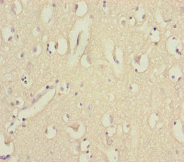 Immunohistochemistry of paraffin-embedded human brain tissue using EEF1A2 Antibody at dilution of 1:100Rabbit anti-Human EEF1A2 Polyclonal Antibody