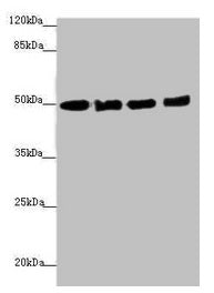 Western blot  | All lanes: EEF1A2 antibody at 1.46µg/ml  | Lane 1: MCF-7 whole cell lysate  | Lane 2: Hela whole cell lysate  | Lane 3: Raji whole cell lysate  | Lane 4: A431 whole cell lysate  | Secondary  | Goat polyclonal to rabbit IgG at 1/10000 dilution  | Predicted band size: 50 kDa  | Observed band size: 50 kDaRabbit anti-Human EEF1A2 Polyclonal Antibody