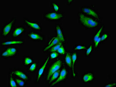 Immunofluorescent analysis of Hela cells using EEF1E1 Antibody at dilution of 1:100 and Alexa Fluor 488-congugated AffiniPure Goat Anti-Rabbit IgG(H+L)
