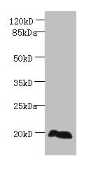Western blot  | All lanes: EEF1E1 antibody at 2µg/ml + HepG2 whole cell lysate  | Secondary  | Goat polyclonal to rabbit IgG at 1/10000 dilution  | Predicted band size: 20, 16 kDa  | Observed band size: 20 kDa