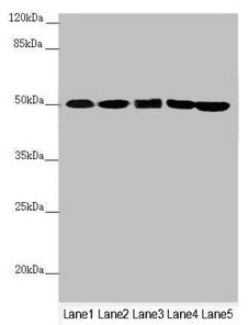Western blot  | All lanes: EEF1G antibody at 0.78µg/ml  | Lane 1: Mouse gonadal tissue  | Lane 2: PC-3 whole cell lysate  | Lane 3: HepG2 whole cell lysate  | Lane 4: Hela whole cell lysate  | Lane 5: 293T whole cell lysate  | Secondary  | Goat polyclonal to rabbit IgG at 1/10000 dilution  | Predicted band size: 51, 57 kDa  | Observed band size: 51 kDaRabbit anti-Human EEF1G Polyclonal Antibody