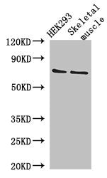 Western Blot  | Positive WB detected in: HEK293 whole cell lysate, Mouse skeletal muscle tissue  | All lanes: EFCAB7 antibody at 2.8μg/ml  | Secondary  | Goat polyclonal to rabbit IgG at 1/50000 dilution  | Predicted band size: 72, 70 kDa  | Observed band size: 72 kDaRabbit anti-Human EFCAB7 Polyclonal Antibody