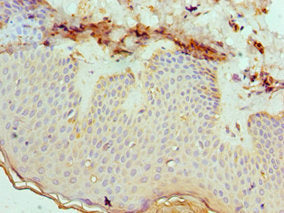 Immunohistochemistry of paraffin-embedded human skin tissue using EFNB2 Antibody at dilution of 1:100Rabbit anti-Human EFNB2 Polyclonal Antibody