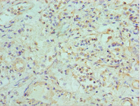 Immunohistochemistry of paraffin-embedded human kidney tissue using EFNB2 Antibody at dilution of 1:100Rabbit anti-Human EFNB2 Polyclonal Antibody