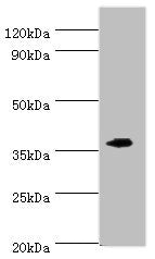 Western blot | All lanes: EFNB2 antibody at 6μg/ml + Mouse kidney tissue | Secondary | Goat polyclonal to rabbit IgG at 1/10000 dilution | Predicted band size: 37 kDa | Observed band size: 37 kDaRabbit anti-Human EFNB2 Polyclonal Antibody