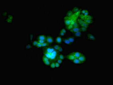 Immunofluorescent analysis of PC-3 cells using EGLN2 Antibody at dilution of 1:100 and Alexa Fluor 488-congugated AffiniPure Goat Anti-Rabbit IgG(H+L)Rabbit anti-Human EGLN2 Polyclonal Antibody