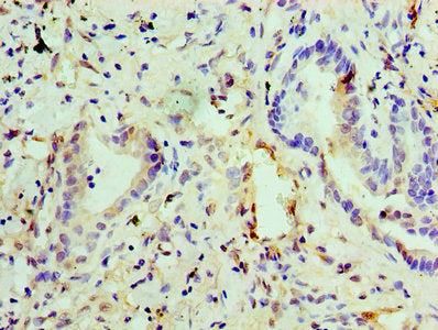 Immunohistochemistry of paraffin-embedded human lung tissue using the antibody at dilution of 1:100Rabbit anti-Human EGLN2 Polyclonal Antibody