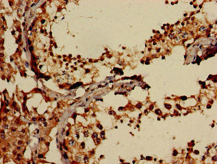 Immunohistochemistry of paraffin-embedded human testis tissue using EIF2AK1 Antibody at dilution of 1:100Rabbit anti-Human EIF2AK1 Polyclonal Antibody