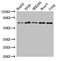 Western BlotPositive WB detected in: HepG2 whole cell lysate, A549 whole cell lysate, HEK293 whole cell lysate, Rat heart tissue, Rat lung tissueAll lanes: EIF2AK1 antibody at 3μg/mlSecondaryGoat polyclonal to rabbit IgG at 1/50000 dilutionPredicted band size: 72 kDaObserved band size: 72 kDaRabbit anti-Human EIF2AK1 Polyclonal Antibody