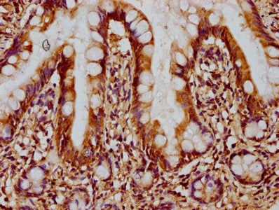 IHC image of EIF2AK3 Antibody diluted at 1:300 and staining in paraffin-embedded human small intestine tissue performed on a Leica BondTM system. After dewaxing and hydration, antigen retrieval was mediated by high pressure in a citrate buffer (pH 6.0). Section was blocked with 10% normal goat serum 30min at RT. Then primary antibody (1% BSA) was incubated at 4°C overnight. The primary is detected by a biotinylated secondary antibody and visualized using an HRP conjugated SP system.Rabbit anti-Human EIF2AK3 Polyclonal Antibody
