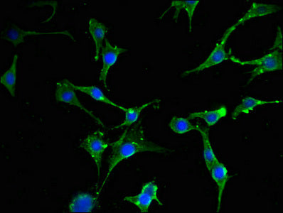 Immunofluorescent analysis of MCF-7 cells using EIF2S1 Antibody at dilution of 1:100 and Alexa Fluor 488-congugated AffiniPure Goat Anti-Rabbit IgG(H+L)