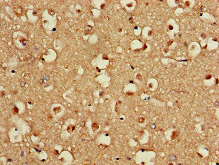 Immunohistochemistry of paraffin-embedded human brain tissue using EIF2S1 Antibody at dilution of 1:100