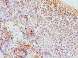 Immunohistochemistry of paraffin-embedded human pancreatic tissue using EIF2S3 Antibody at dilution of 1:100Rabbit anti-Human EIF2S3 Polyclonal Antibody