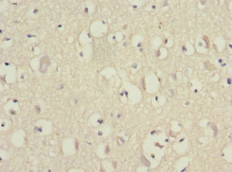 Immunohistochemistry of paraffin-embedded human brain tissue using the antibody at dilution of 1:100Rabbit anti-Human EIF3F Polyclonal Antibody