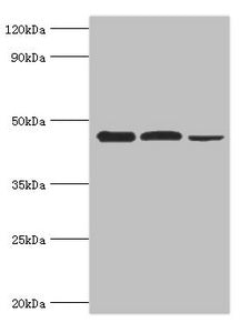 Western blot | All lanes: Eukaryotic initiation factor 4A-I antibody at 3μg/ml | Lane 1: K562 whole cell lysate | Lane 2: Hela whole cell lysate | Lane 3: Rat brain tissue | Secondary | Goat polyclonal to rabbit IgG at 1/10000 dilution | Predicted band size: 47, 40 kDa | Observed band size: 47 kDaRabbit anti-Human EIF4A1 Polyclonal Antibody