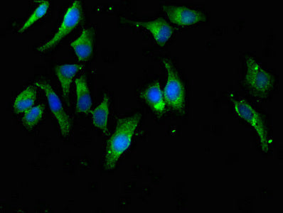 Immunofluorescent analysis of Hela cells using EIF4B Antibody at dilution of 1:100 and Alexa Fluor 488-congugated AffiniPure Goat Anti-Rabbit IgG(H+L)Rabbit anti-Human EIF4B Polyclonal Antibody