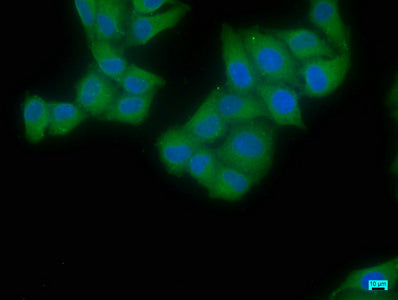 Immunofluorescence staining of Hela cells with EIF4G2 Antibody at 1:50, counter-stained with DAPI. The cells were fixed in 4% formaldehyde, permeabilized using 0.2% Triton X-100 and blocked in 10% normal Goat Serum. The cells were then incubated with the antibody overnight at 4°C. The secondary antibody was Alexa Fluor 488-congugated AffiniPure Goat Anti-Rabbit IgG(H+L).Rabbit anti-Human EIF4G2 Polyclonal Antibody