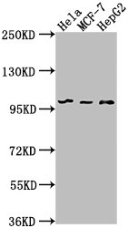 Western Blot | Positive WB detected in: Hela whole cell lysate, MCF-7 whole cell lysate, HepG2 whole cell lysate | All lanes: EIF4G2 antibody at 1:1000 | Secondary | Goat polyclonal to rabbit IgG at 1/50000 dilution | Predicted band size: 103, 99 kDa | Observed band size: 99 kDaRabbit anti-Human EIF4G2 Polyclonal Antibody