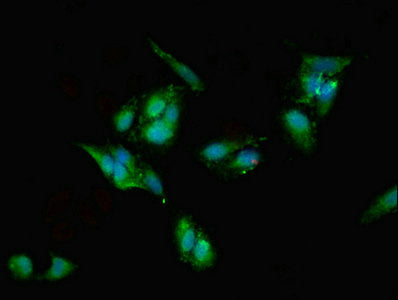Immunofluorescent analysis of Hela cells using EIF6 Antibody at dilution of 1:100 and Alexa Fluor 488-congugated AffiniPure Goat Anti-Rabbit IgG(H+L)Rabbit anti-Human EIF6 Polyclonal Antibody