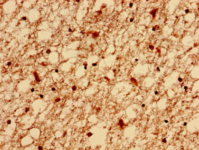 Immunohistochemistry analysis of human brain tissue using ELAVL2 Antibody at dilution of 1:100Rabbit anti-Human ELAVL2 Polyclonal Antibody