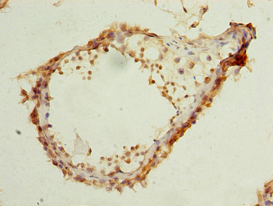 Immunohistochemistry of paraffin-embedded human testis tissue using ELAVL4 Antibody at dilution of 1:100Rabbit anti-Human ELAVL4 Polyclonal Antibody
