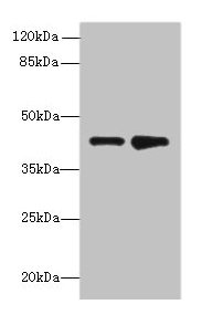 Western blot  | All lanes: ELAVL4 antibody at 2µg/ml  | Lane 1: MCF-7 whole cell lysate  | Lane 2: 293T whole cell lysate  | Secondary  | Goat polyclonal to rabbit IgG at 1/10000 dilution  | Predicted band size: 42, 41, 43 kDa  | Observed band size: 42 kDaRabbit anti-Human ELAVL4 Polyclonal Antibody