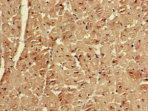 Immunohistochemistry of paraffin-embedded human heart tissue using EMD Antibody at dilution of 1:100Rabbit anti-Human EMD Polyclonal Antibody