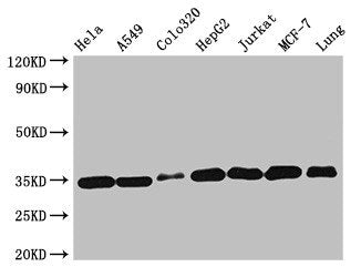 Western Blot  | Positive WB detected in: Hela whole cell lysate, A549 whole cell lysate, Colo320 whole cell lysate, HepG2 whole cell lysate, Jurkat whole cell lysate, MCF-7 whole cell lysate, Mouse lung tissue  | All lanes: EMD antibody at 2µg/ml  | Secondary  | Goat polyclonal to rabbit IgG at 1/50000 dilution  | Predicted band size: 29 kDa  | Observed band size: 35 kDaRabbit anti-Human EMD Polyclonal Antibody