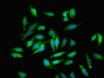 Immunofluorescent analysis of Hela cells using EML2 Antibody at dilution of 1:100 and Alexa Fluor 488-congugated AffiniPure Goat Anti-Rabbit IgG(H+L)Rabbit anti-Human EML2 Polyclonal Antibody