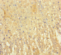 Immunohistochemistry of paraffin-embedded human adrenal gland tissue using the antibody at dilution of 1:100Rabbit anti-Human EML2 Polyclonal Antibody