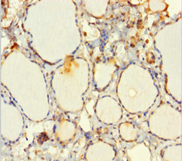 Immunohistochemistry of paraffin-embedded human thyroid tissue using EML2 Antibody at dilution of 1:100Rabbit anti-Human EML2 Polyclonal Antibody