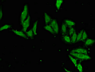 Immunofluorescent analysis of Hela cells using EN2 Antibody at dilution of 1:100 and Alexa Fluor 488-congugated AffiniPure Goat Anti-Rabbit IgG(H+L)Rabbit anti-Human EN2 Polyclonal Antibody
