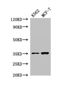 Western Blot  | Positive WB detected in: K562 whole cell lysate, MCF-7 whole cell lysate  | All lanes: EN2 antibody at 2.8µg/ml  | Secondary  | Goat polyclonal to rabbit IgG at 1/50000 dilution  | Predicted band size: 35 kDa  | Observed band size: 35 kDaRabbit anti-Human EN2 Polyclonal Antibody