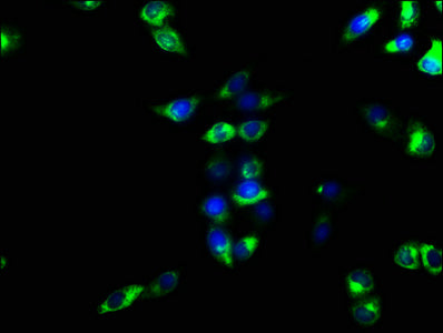 Immunofluorescence staining of Hela cells with ENTPD1 Antibody at 1:166, counter-stained with DAPI. The cells were fixed in 4% formaldehyde, permeabilized using 0.2% Triton X-100 and blocked in 10% normal Goat Serum. The cells were then incubated with the antibody overnight at 4°C. The secondary antibody was Alexa Fluor 488-congugated AffiniPure Goat Anti-Rabbit IgG(H+L).Rabbit anti-Human ENTPD1 Polyclonal Antibody