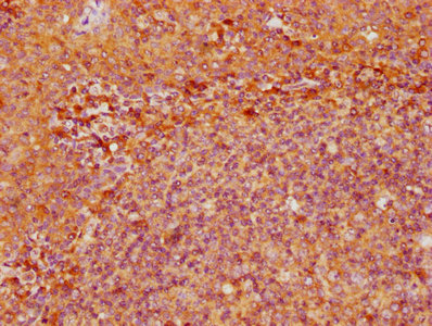 IHC image of ENTPD1 Antibody diluted at 1:500 and staining in paraffin-embedded human tonsil tissue performed on a Leica BondTM system. After dewaxing and hydration, antigen retrieval was mediated by high pressure in a citrate buffer (pH 6.0). Section was blocked with 10% normal goat serum 30min at RT. Then primary antibody (1% BSA) was incubated at 4°C overnight. The primary is detected by a biotinylated secondary antibody and visualized using an HRP conjugated SP system.Rabbit anti-Human ENTPD1 Polyclonal Antibody