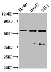 Western Blot  | Positive WB detected in: HL-60 whole cell lysate, HepG2 whole cell lysate, U251 whole cell lysate  | All lanes: ENTPD1 antibody at 2.6μg/ml  | Secondary  | Goat polyclonal to rabbit IgG at 1/50000 dilution  | Predicted band size: 58, 59, 35, 43, 47, 60 kDa  | Observed band size: 58, 43 kDaRabbit anti-Human ENTPD1 Polyclonal Antibody