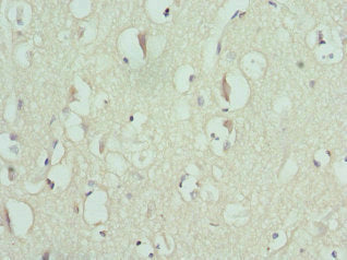 Immunohistochemistry of paraffin-embedded human brain tissue using ENTPD2 Antibody at dilution of 1:100Rabbit anti-Human ENTPD2 Polyclonal Antibody
