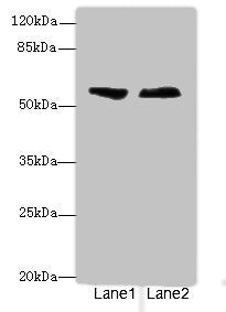 Western blot | All lanes: ENTPD2antibody at 3.6μg/ml | Lane 1: Human placenta tissue | Lane 2: U87 whole cell lysate | Secondary | Goat polyclonal to rabbit IgG at 1/10000 dilution | Predicted band size: 54, 52, 49 kDa | Observed band size: 54 kDaRabbit anti-Human ENTPD2 Polyclonal Antibody