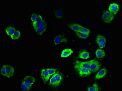 Immunofluorescent analysis of MCF-7 cells using the antibody at dilution of 1:100 and Alexa Fluor 488-congugated AffiniPure Goat Anti-Rabbit IgG(H+L)Rabbit anti-Human ENTPD3 Polyclonal Antibody
