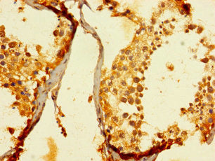 Immunohistochemistry of paraffin-embedded human testis tissue using ENTPD3 Antibody at dilution of 1:100Rabbit anti-Human ENTPD3 Polyclonal Antibody