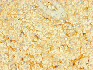 Immunohistochemistry of paraffin-embedded human adrenal gland tissue using ENTPD3 Antibody at dilution of 1:100Rabbit anti-Human ENTPD3 Polyclonal Antibody