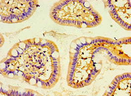 Immunohistochemistry of paraffin-embedded human small intestine tissue using ENTPD5 Antibody at dilution of 1:100Rabbit anti-Human ENTPD5 Polyclonal Antibody
